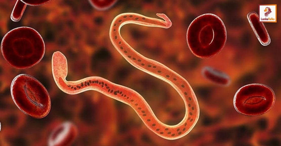 SL targets eliminating filarial worms