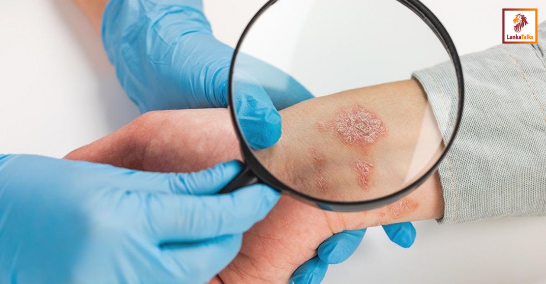 Skin cancer takes the spotlight