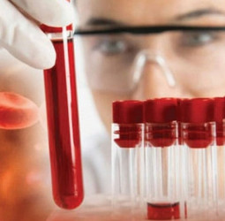 45–60 Children born annually with Thalassemia